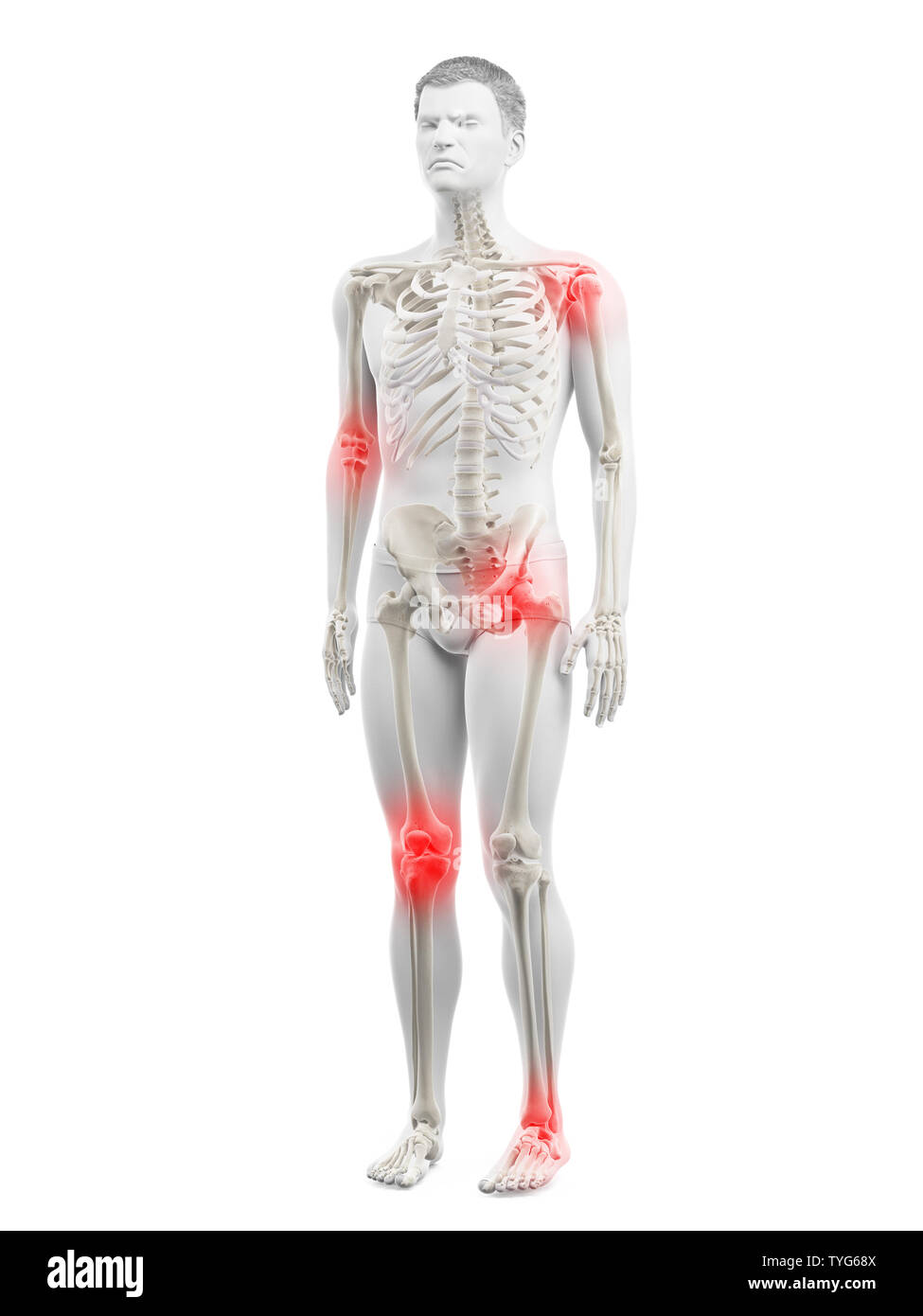 Médicalement en rendu 3d illustration d'un précise mans joints douloureux Banque D'Images