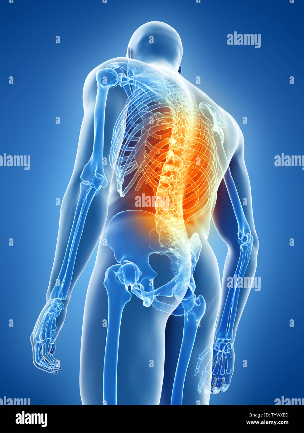 Médicalement en rendu 3d illustration précise d'un homme ayant le mal de dos Banque D'Images