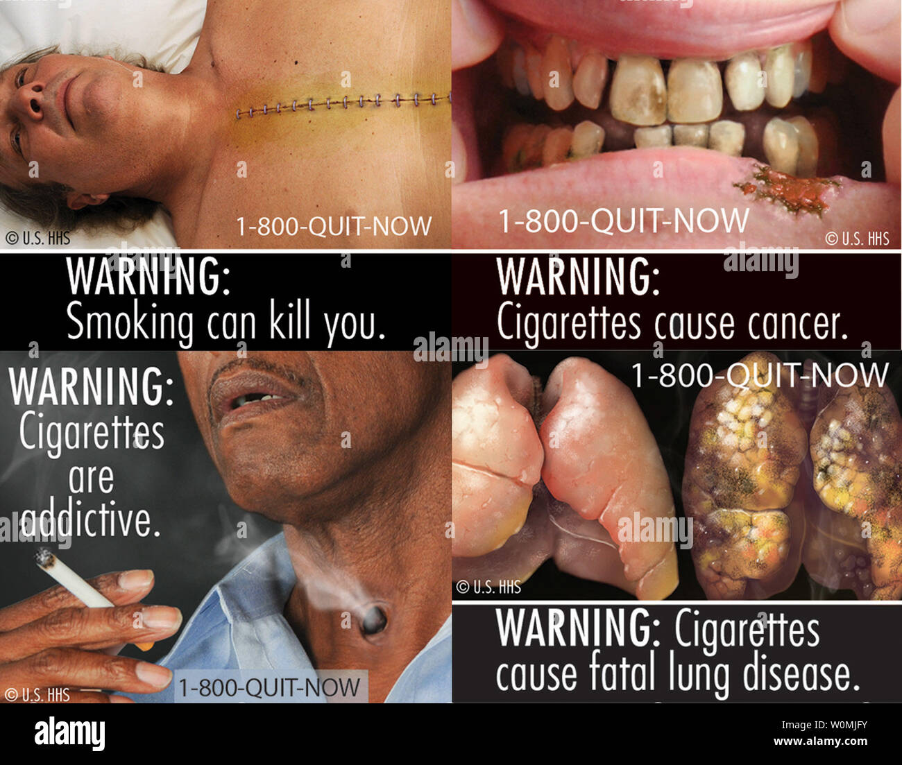 Cette compilation d'images montre quatre des neuf nouvelles tiquettes  d'avertissement de la FDA les fabricants de cigarettes seront tenus de  mettre sur leurs paquets de cigarettes, 21 juin 2011. Dbut septembre 2012,