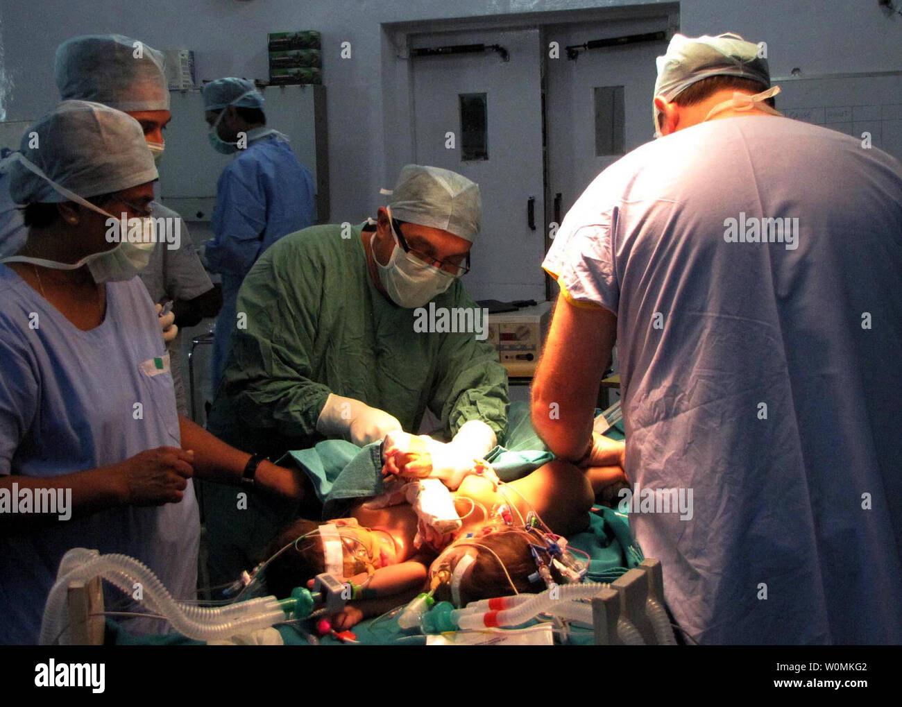 Les médecins opèrent sur nne ans jumeaux siamois Stuti et Aradhna apparaissent à un hôpital à Betul, Madhya Pradesh, Inde le 20 juin 2012. Les jumeaux, qui ont été jointes à la poitrine, ont été séparés hier à 12 heures d'opération impliquant 23 médecins et 11 infirmières de l'Inde et l'Australie. . UPI/ Str.. Banque D'Images