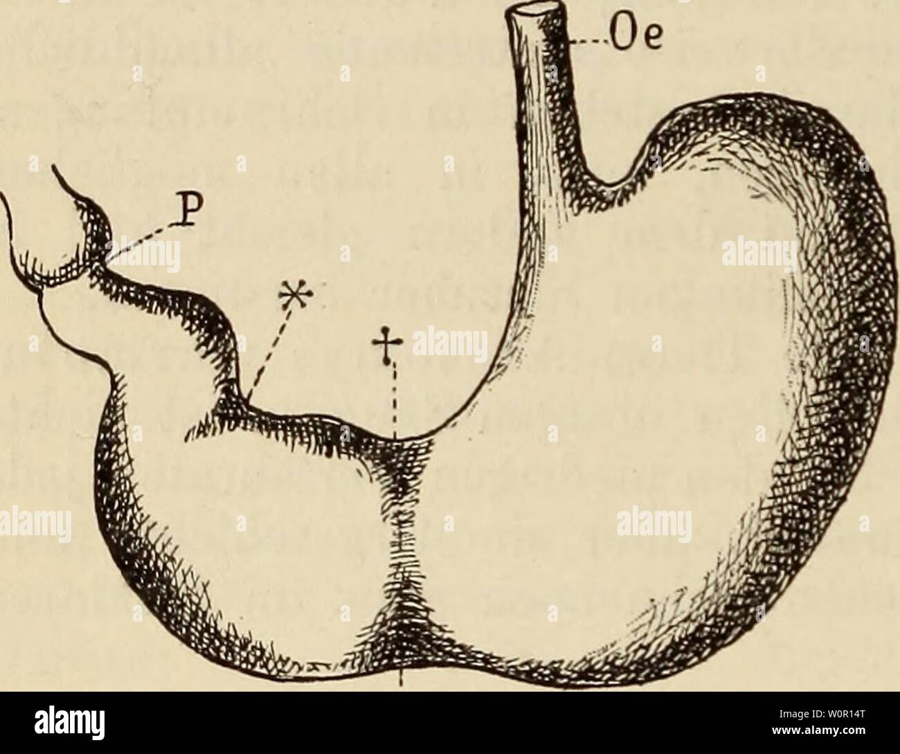 Colon Transversum Banque D Image Et Photos Alamy