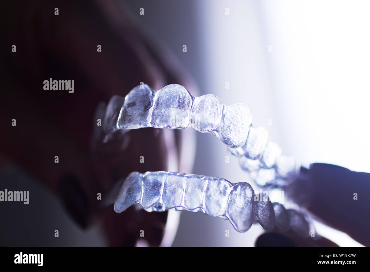 Dents dentaire claire entre crochets de retenue pour redresser et aligner chaque dent dans la dentisterie moderne de la technologie. Banque D'Images