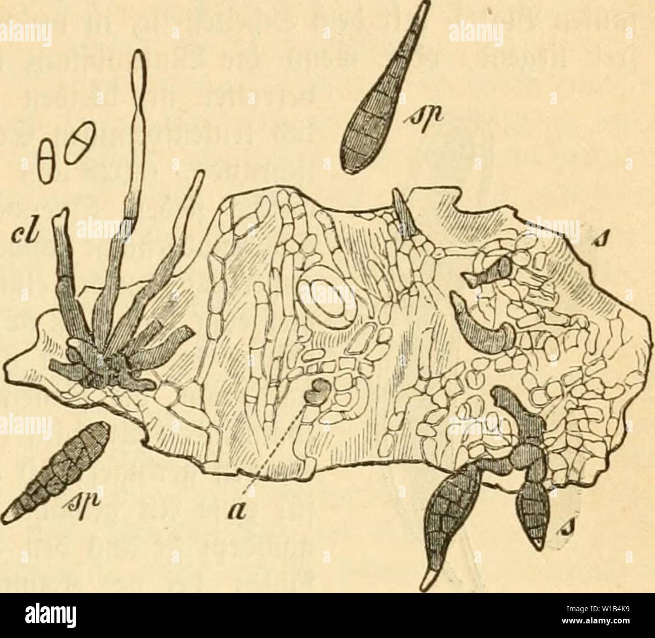 Image d'archive à partir de la page 314 de Die frauenspezifische der Pflanzen, ein. Die frauenspezifische der Pflanzen, ein handbuch fur terre-und forstwirte, Gartner, gartenfreunde und botaniker . diekrankheitende02fran Année : 1895 13. .'Pyrenomycetps artigen 299 Chapitre : oHöbmunen UberjugeS oniMenfonn 6bie Sporidesmium putre- iaciens accarbo. Juckel beil iat 5]3fij dans Clasterosporium putrefaciens Sacc. umbenannt inbeö Unreclt ; ganj mit, benn Der 9ame Clasterosporium biejenigen ift für ?5oi"tm aufgeftollt morbeu, beren Sporen nur luerfcl €)eibe luänbe befien mcibrenb =, ber 9iübenpil fet5)r t)aud ßäng ciufig) einige Banque D'Images