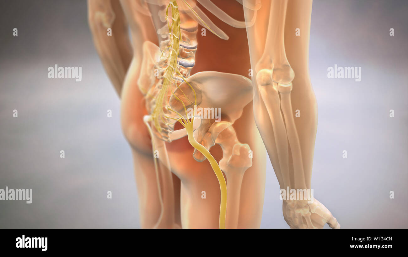Nerf sciatique avec www.medimage3d.com squelette de verre Banque D'Images