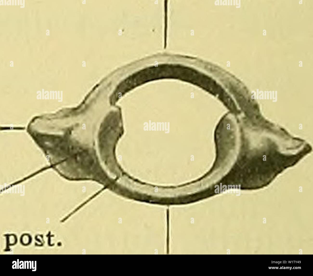 Image d'archive à partir de la page 527 du Medicinisch-Naturwissenschaftlichen Denkschriften der Gesellschaft zu. Denkschriften der Medicinisch-Naturwissenschaftlichen denkschriftender Gesellschaft zu Jena62medi Année : 1879 Fov. artic. ant. Intergle Foveola Proc. transv.- Massa lat. Fac. artic. post sont. ventrale. Fig. 16. L'Échidné erwachsenen und Atlas von oben und. Un etwas von hinten b, von vorn, c von hinten. 9- nat io/Gr. anterior für einen Condylus occipital ; die beiderseitigen Gruben werden durch die Fläche dorsale-craniale des ventralen Atlasbogens zu einer grossen, hufeisenförmig gekrümmten Fa Banque D'Images