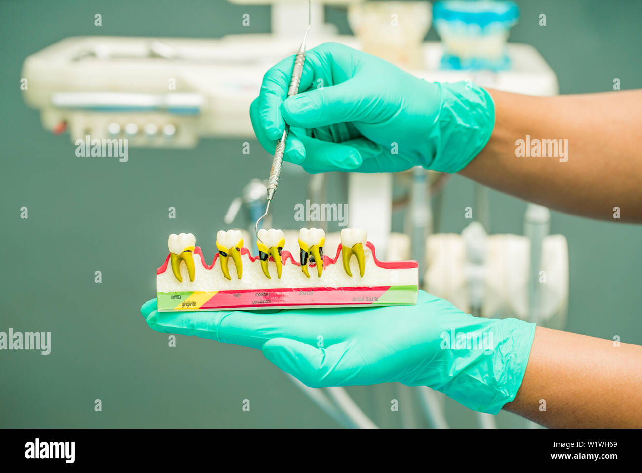 Tenir la main modèle dentaire dentiste en cabinet dentaire Banque D'Images