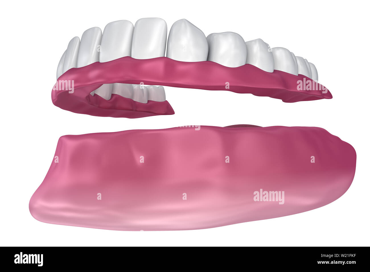 Toutes les dents manquantes - Prothèse complète amovible. 3D illustration Banque D'Images