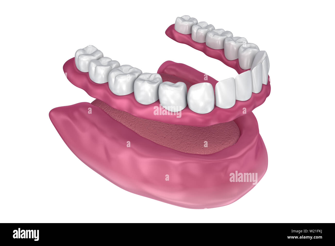 Toutes les dents manquantes - Prothèse complète amovible. 3D illustration Banque D'Images