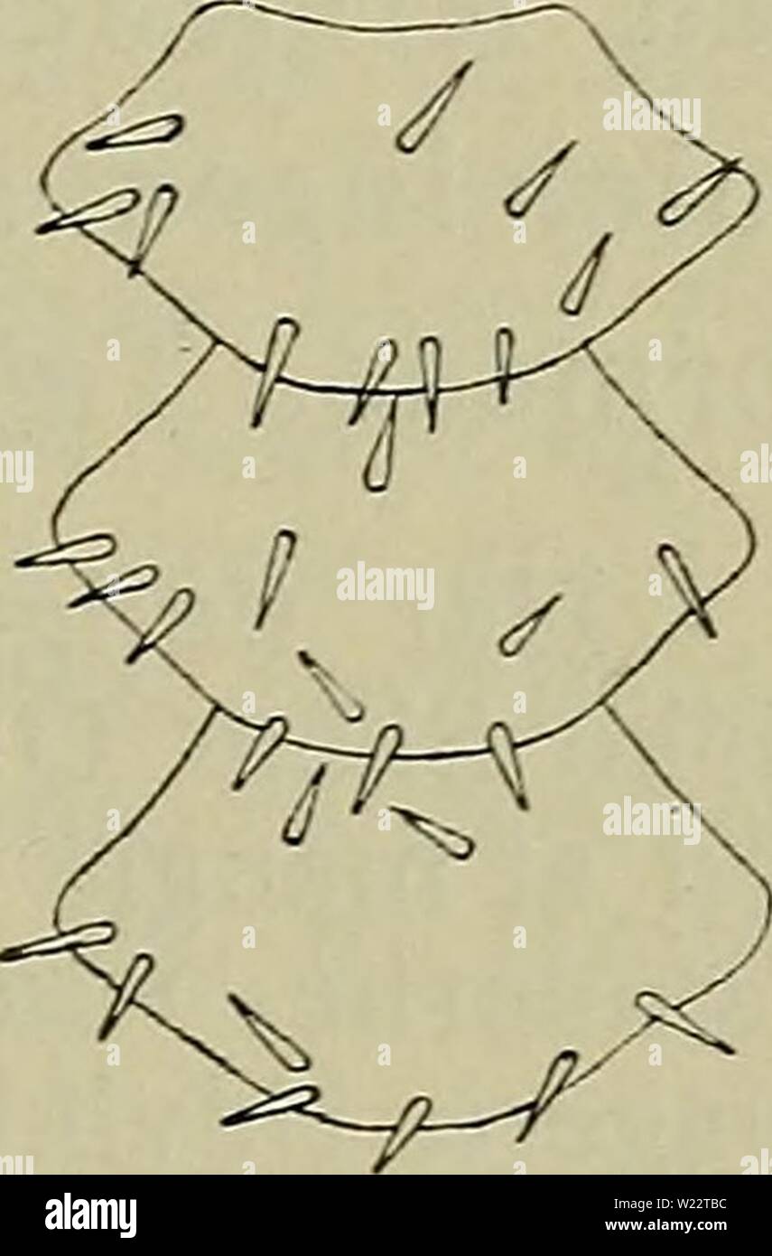 Image d'archive à partir de la page 110 de la faune ; illustrerede haandbøger plus. Illustrerede haandbøger la faune ; plus de den danske dyreverden danmarksfaunaill..27dans Année : 1907 da 107 naesten tvaers j'en ret Linie sur mon corps ovenfor og nedenfor Munden. Ved Forvandlingen bageste Sidearme resorberes de lange ; de ikke tjener som pour Slangestjerne Svaeveapparat den unge, ejendommelig staerkt indrullede ved sine Arme og krogformede Pigge. Tilsidst kastes Larvearmene af, og den unge Ophiur synker- til de banquettes. [Ophiothrix Liitkéni Wyv. Thomson (Fig. 43). Adskiller sig fra O. fragilis navnlig Banque D'Images