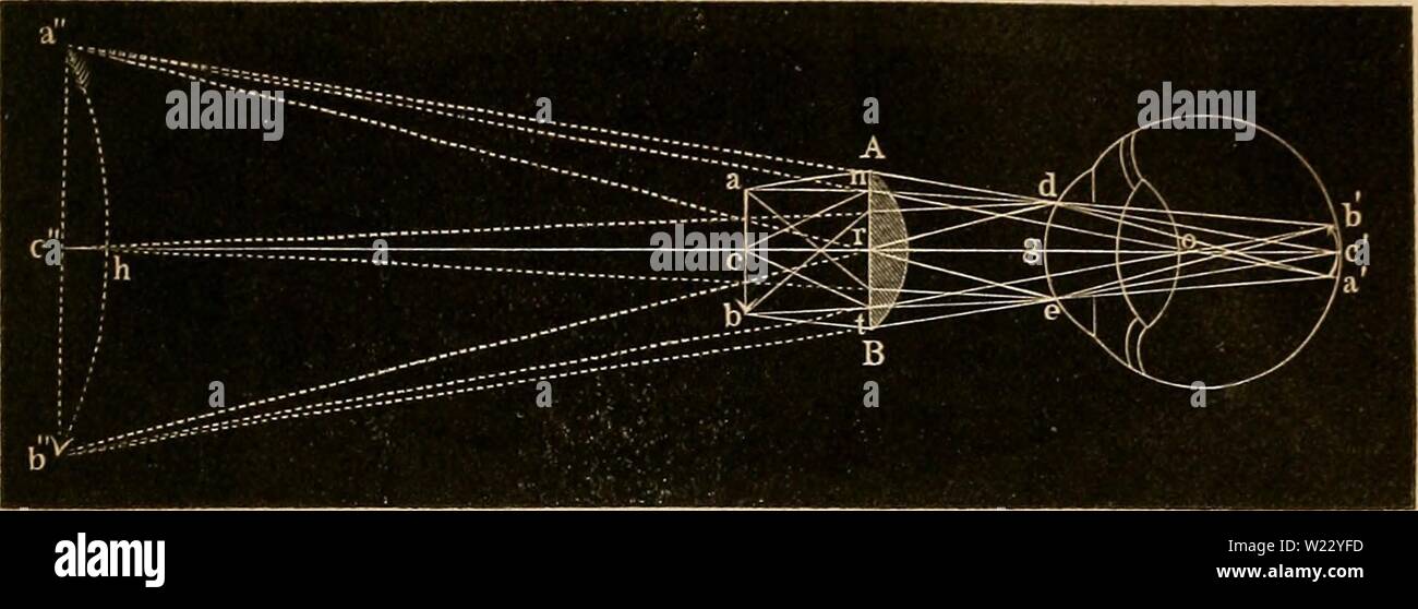 Image d'archive à partir de la page 118 de Das mikroskop Theorie, gebrauch, geschichte. Das mikroskop. Theorie, gebrauch, Geschichte und gegenwärtiger zustand desselben dasmikroskoptheo00hart Année : 1859 Lupe. 93 er, dass, wenn die Grösse vermehrt auf solche Weise, wird die Deut- lichkeit des Gesichtseindruckes mehr als verliert gewinnt. Um näher darzuthun, welche auf eine einzelne Weise Linse 109 uns die Gegenstände vergrossert vorführt verfolgen, den wir der Gang Strahlen von einem objecte bis zur Netzhaut. Wenn ah (Fig. 50) ein Fig. 50. Welches ist, de l'objet (vor sich AB Linse befindet, dann wer Banque D'Images