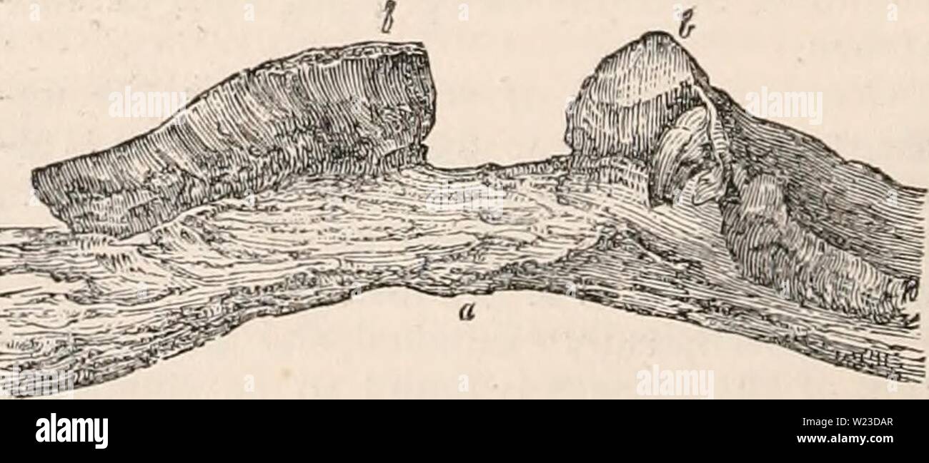 Image d'archive à partir de la page 155 de la cyclopaedia d'anatomie et de Banque D'Images