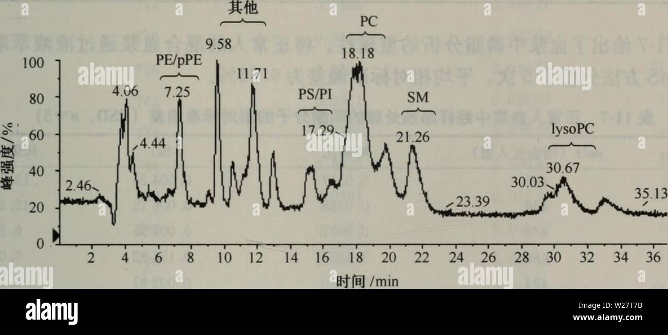 Image d'archive à partir de la page 314 de dai xie zu xue fang. dai xie zu xue fang fa yu ying yong daixiezuxuefangf00xugu : 2008.8 Année¿¶çae çä é'ï¼ä äºç¿Å"èé±äºä¿åè'æ ·ä¹é¿¶çae çä'é'çae³ aeå¨å¢æ¥çè"¦¯¯å·®ãå¨è'ç…"å æ¨¡å¼ä-'ï¼PEã PSåPIç±"ç¢-çååå èåå¦-ç"å-å³°ä'"è¦æ¯ [M-H]-é ç'¦« ï¼PCã ålysoPCç å-SM±"ç£¯èåå-ä'"è¦æ¯[M-H]âã [M-15]âå[M]âé +45 ç'¦« ãå ååç å-ae (C14/C14 . 0 0 PE ., C14/C14 . 0 0 . PS, C14/C14 . 0 0 . PCåC12 0 lysoPC .¯åºäºå éaeae)ç®ä"¬çaeº¶è§§åéè¿£æ è"¨è°±æ"aeè¯aeå®ä"¬¡ae¼¨è å ä¿'-çå"éã1ãéè È¾è¡¯¿æ ç'"ä'-å-aeºç çå³ èåå·£° å¼ºä ¶¯«¹Åºçå å å æ ç£·èååççå³ å¼ºè¡¿è°è¡ae¼¿ä'-ç£·èåå çåå éãå¯®-¹äºPIåSMç±"ç£¯èåå ï¼ç äºç¼ºå-åååçå±° Banque D'Images