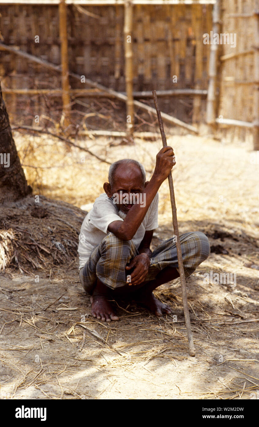 Un homme âgé, survivant de l'cyclone de 1991. Le cyclone de 1991 a été l'un des plus meurtriers sur les cyclones tropicaux qui a frappé le Bangladesh. Le cyclone a frappé le sud-est du district de Chittagong, dans la nuit du 29 avril avec des vents autour de 250 kilomètres par heure. Il y a eu une onde de tempête de 6 mètres sur une vaste zone, tuant au moins 138 000 personnes et faisant plus de 10 millions de sans-abri. Chittagong, Bangladesh. 1991. Source : www.wikipedia.com Banque D'Images