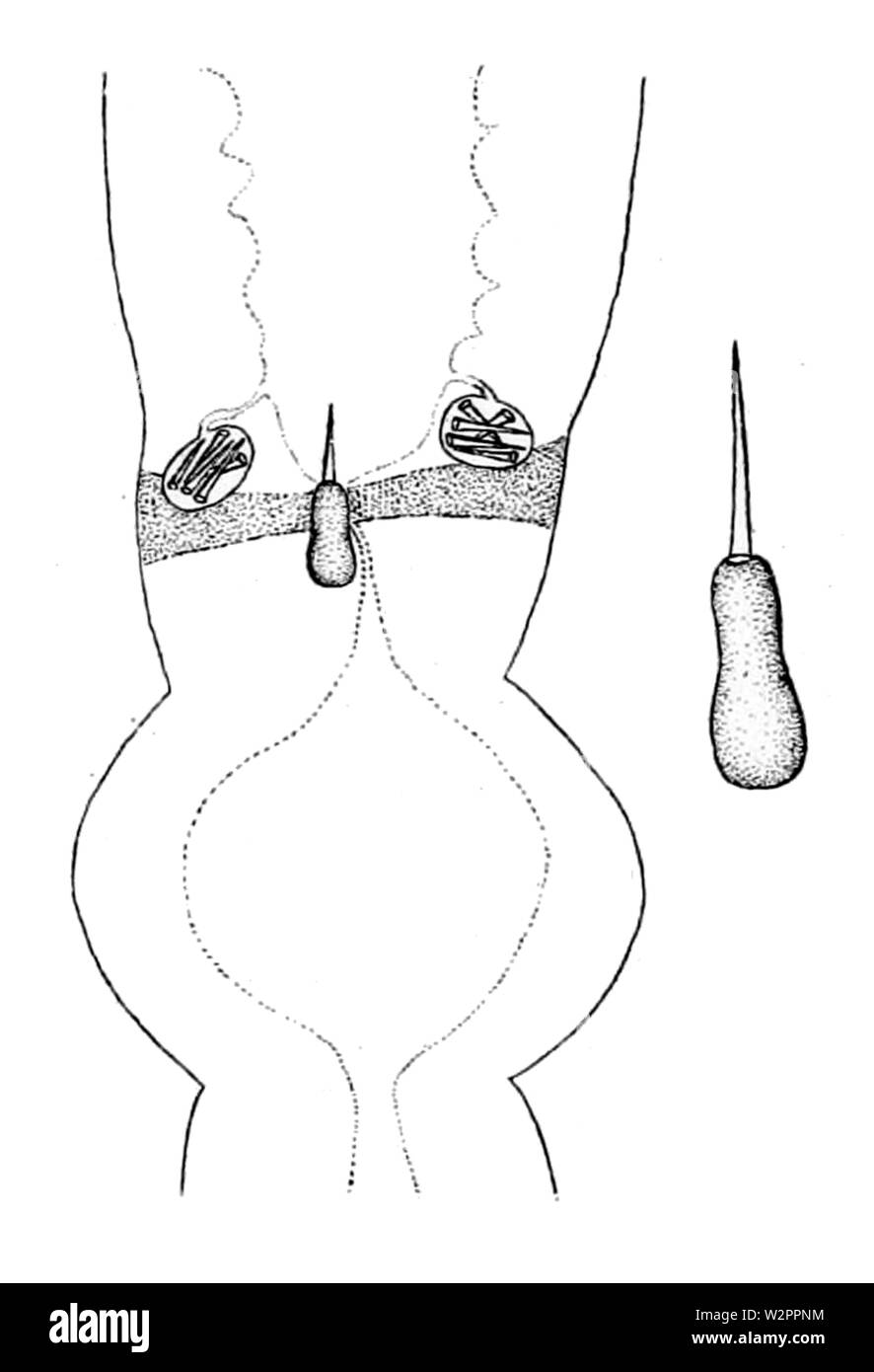 Amphiporus angulatus stylet appareil (à partir de l'Europe, 1901) Banque D'Images