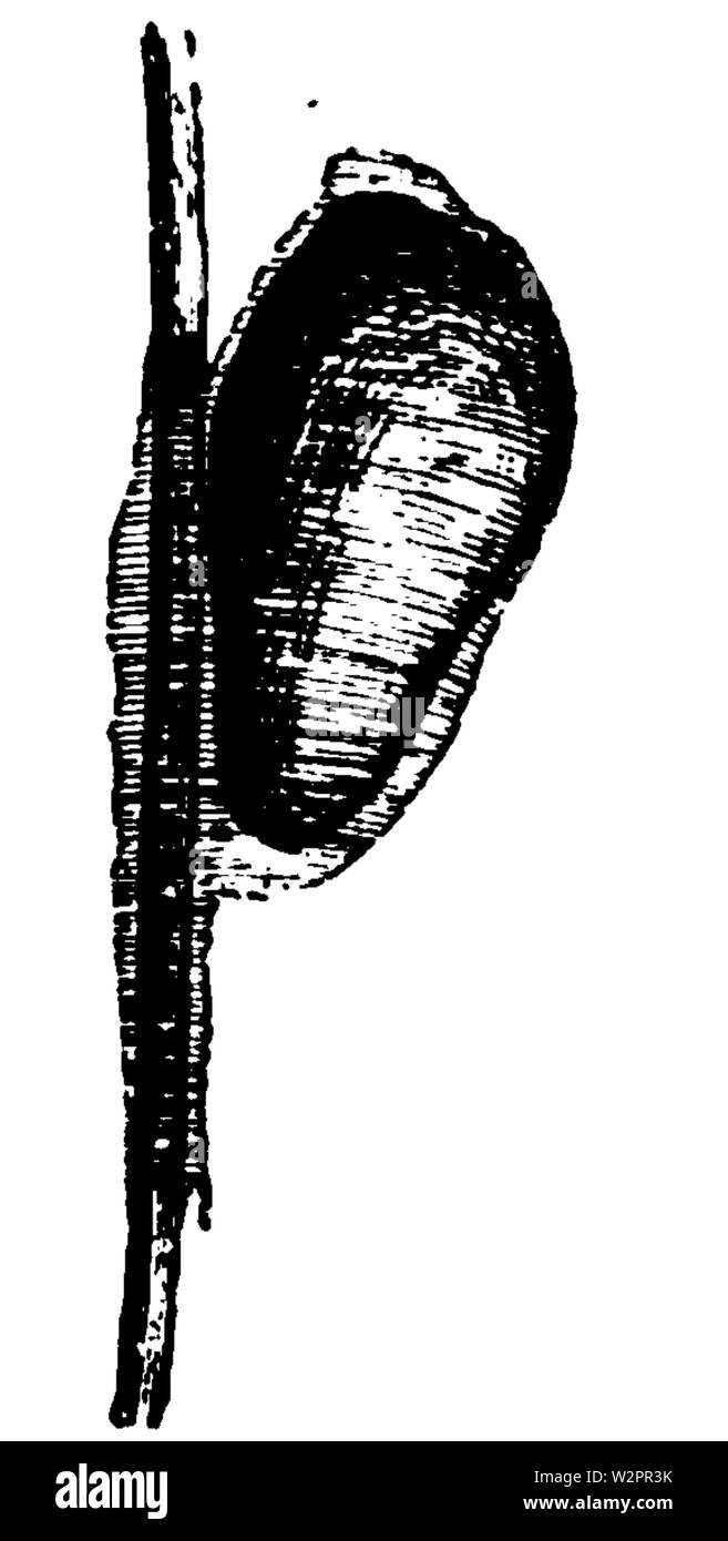 Une introduction à la dermatologie (1905) de l'ovule ou pediculus capitis nit attaché par une gaine pour les cheveux 50x Banque D'Images