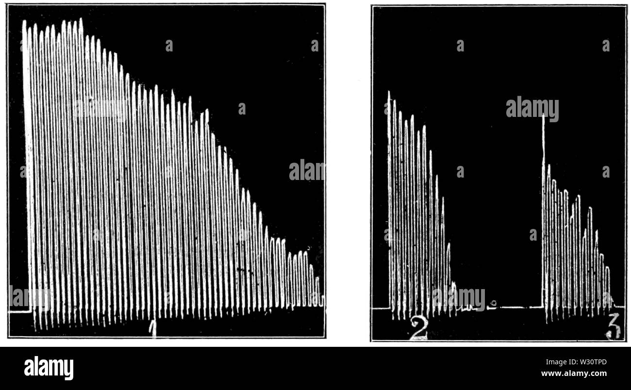 PSM V76 D194 Graphique d'une des contractions musculaires des fléchisseurs des doigts Banque D'Images