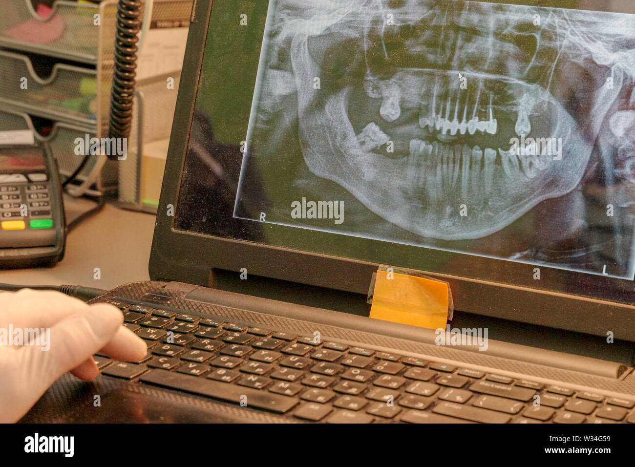 Vue panoramique les radiographies dentaires permettent au dentiste pour voir tous de vos dents leur rapport aux autres et la façon dont elles sont placées dans la mâchoire. Banque D'Images