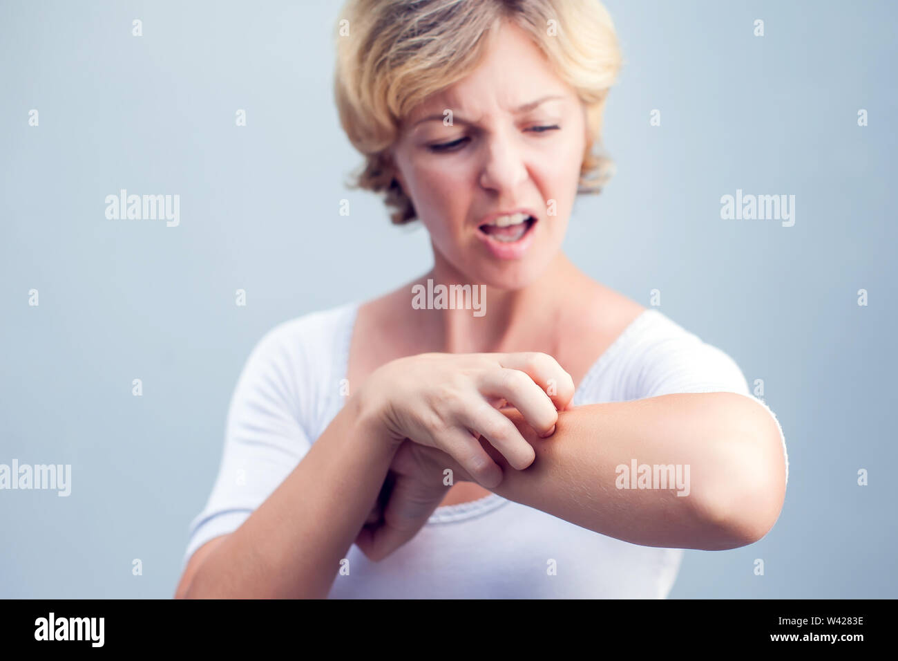 Femme de rayer une démangeaison sur fond blanc . La peau sensible, de l'alimentation des symptômes d'allergie, d'irritation Banque D'Images