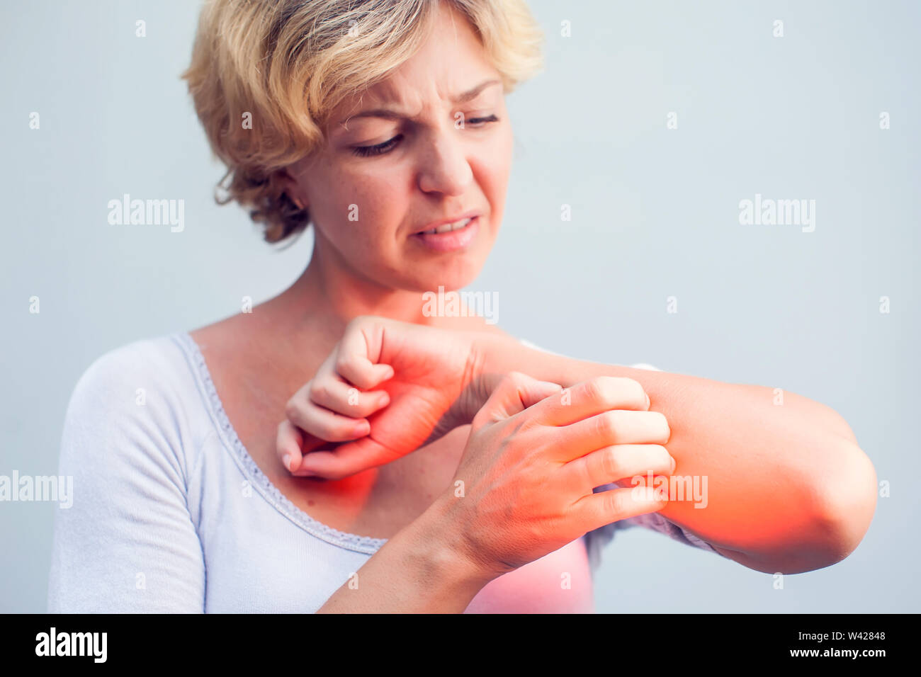 Femme de rayer une démangeaison sur fond blanc . La peau sensible, de l'alimentation des symptômes d'allergie, d'irritation Banque D'Images