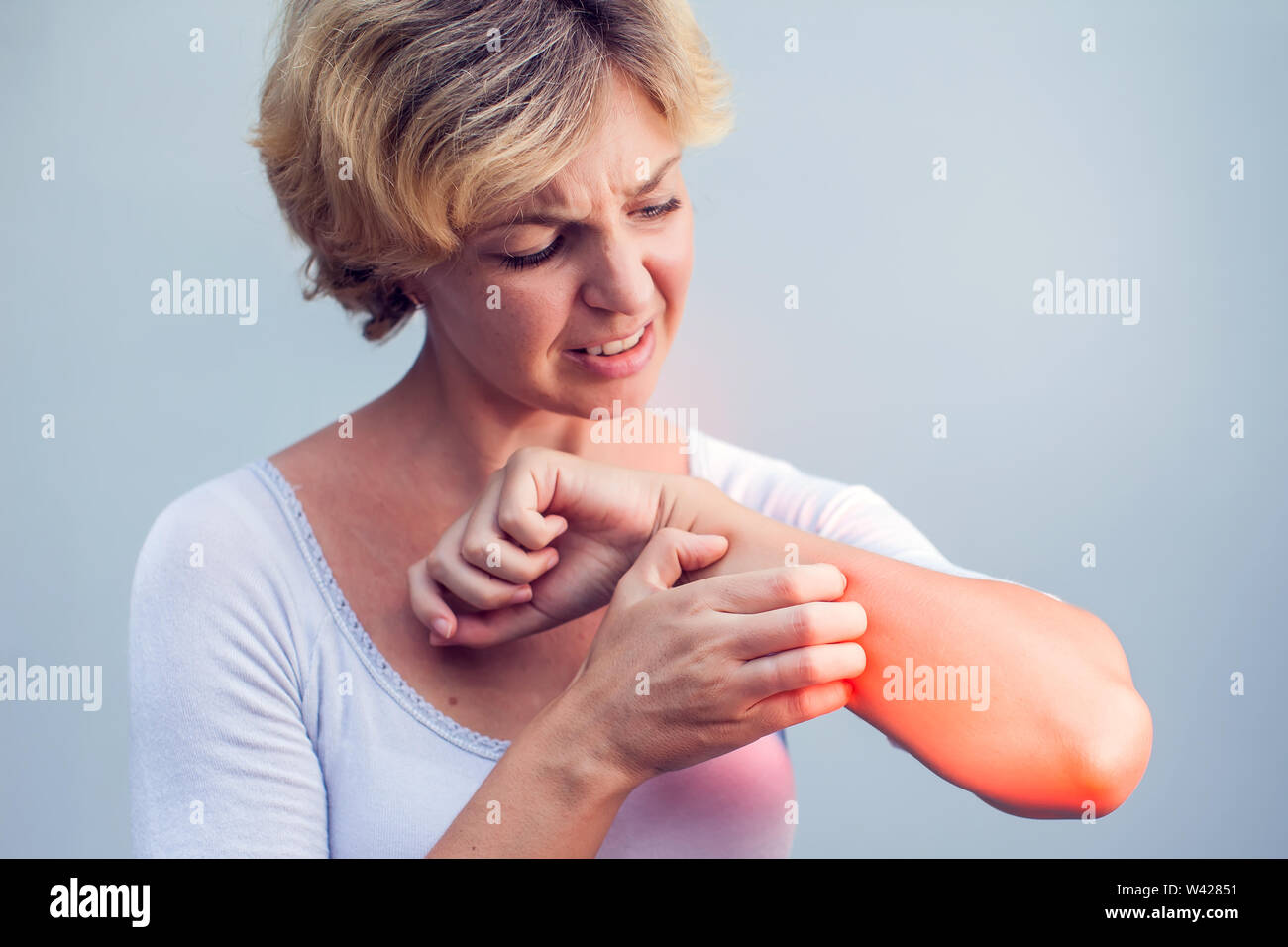 Femme de rayer une démangeaison sur fond blanc . La peau sensible, de l'alimentation des symptômes d'allergie, d'irritation Banque D'Images