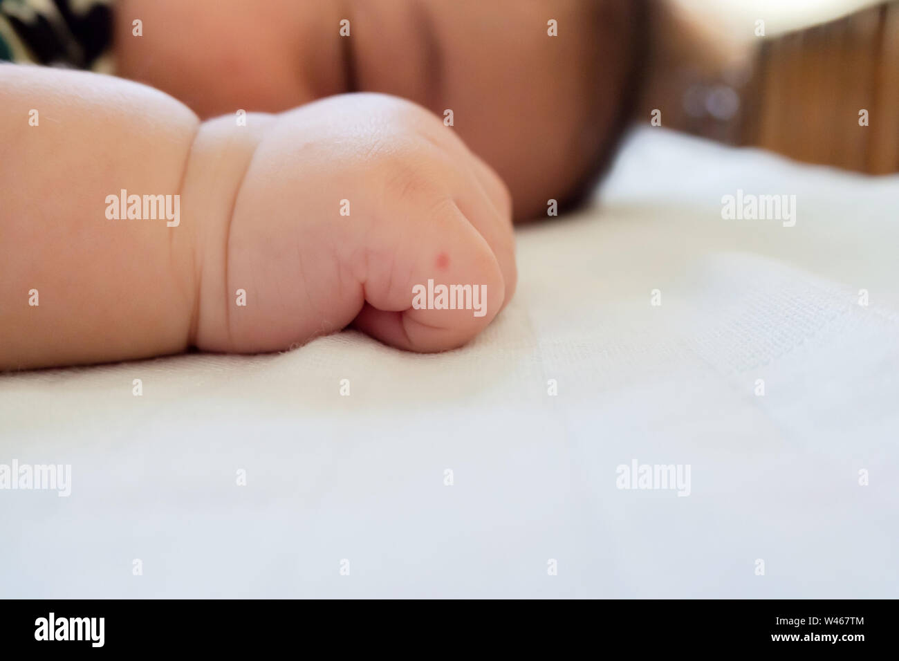 Peau rouge bump à partir de la piqûre de moustique bébé asiatique sur la main tout en dormant dans la chambre à coucher. famille et les soins de concept. Banque D'Images