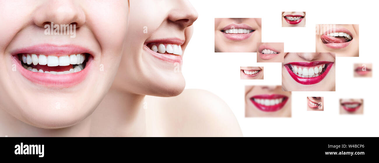 Collage de jeune femme près de collage avec la santé des dents. Banque D'Images