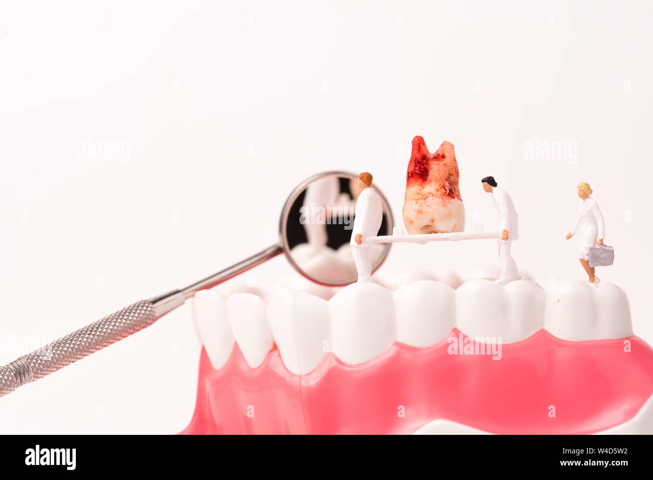personnes miniatures avec outil dentaire et modèle dentaire Banque D'Images