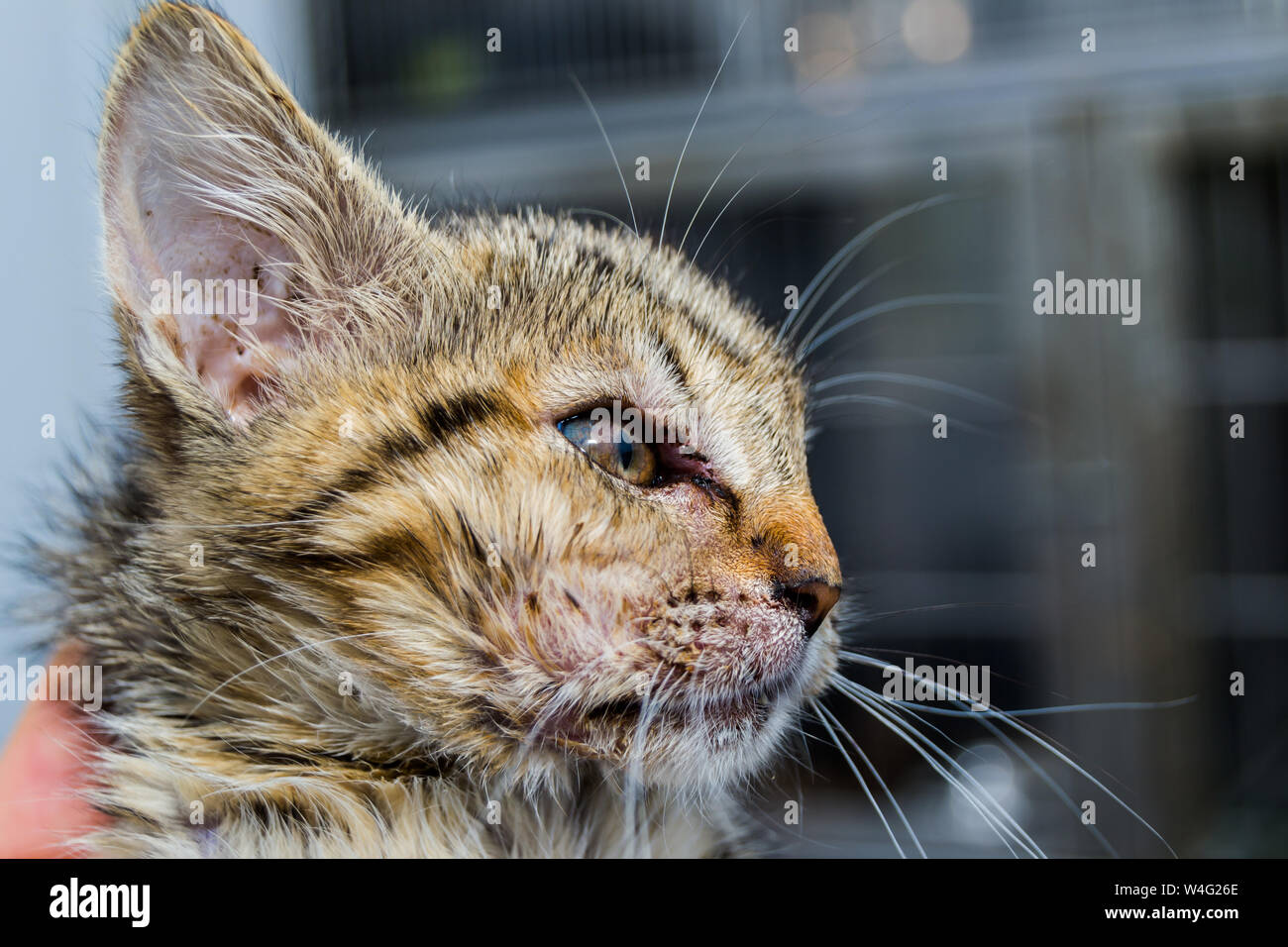 œdeme De Quincke Banque D Image Et Photos Alamy œdeme De Quincke Banque D Image Et Photos Alamy