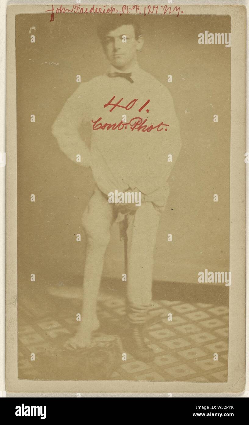 Cas n°1 de John Frederick U.S.V. Vue de face. Raccourcie membre sept pouces., pas de bouilloire, cuisine américaine, 1864-1870, à l'albumine argentique Banque D'Images