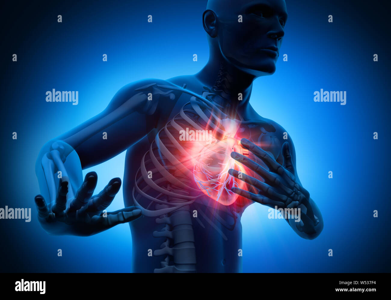 Homme avec une crise cardiaque et une douleur - 3D illustration Banque D'Images