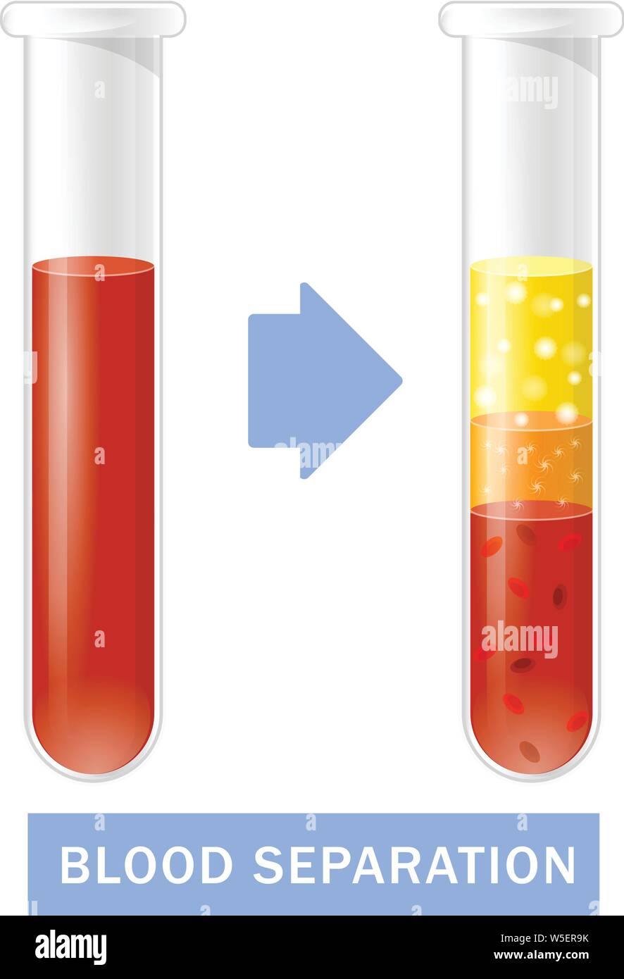 Tube à essai avec du sang après la séparation de plaquettes, PRP infographie, le plasma riche en plaquettes Illustration de Vecteur