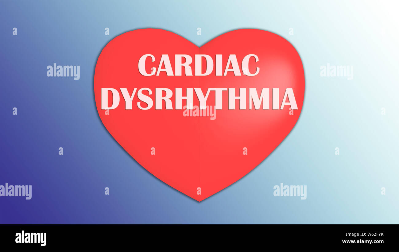 3D illustration de la dysrythmie cardiaque titre sur cœur rouge, jaune isolé sur gradient. Banque D'Images