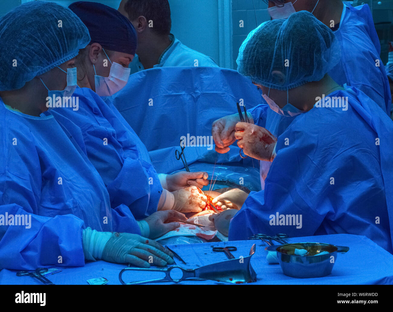 Chirurgie Abdominale Banque d'image et photos - Alamy