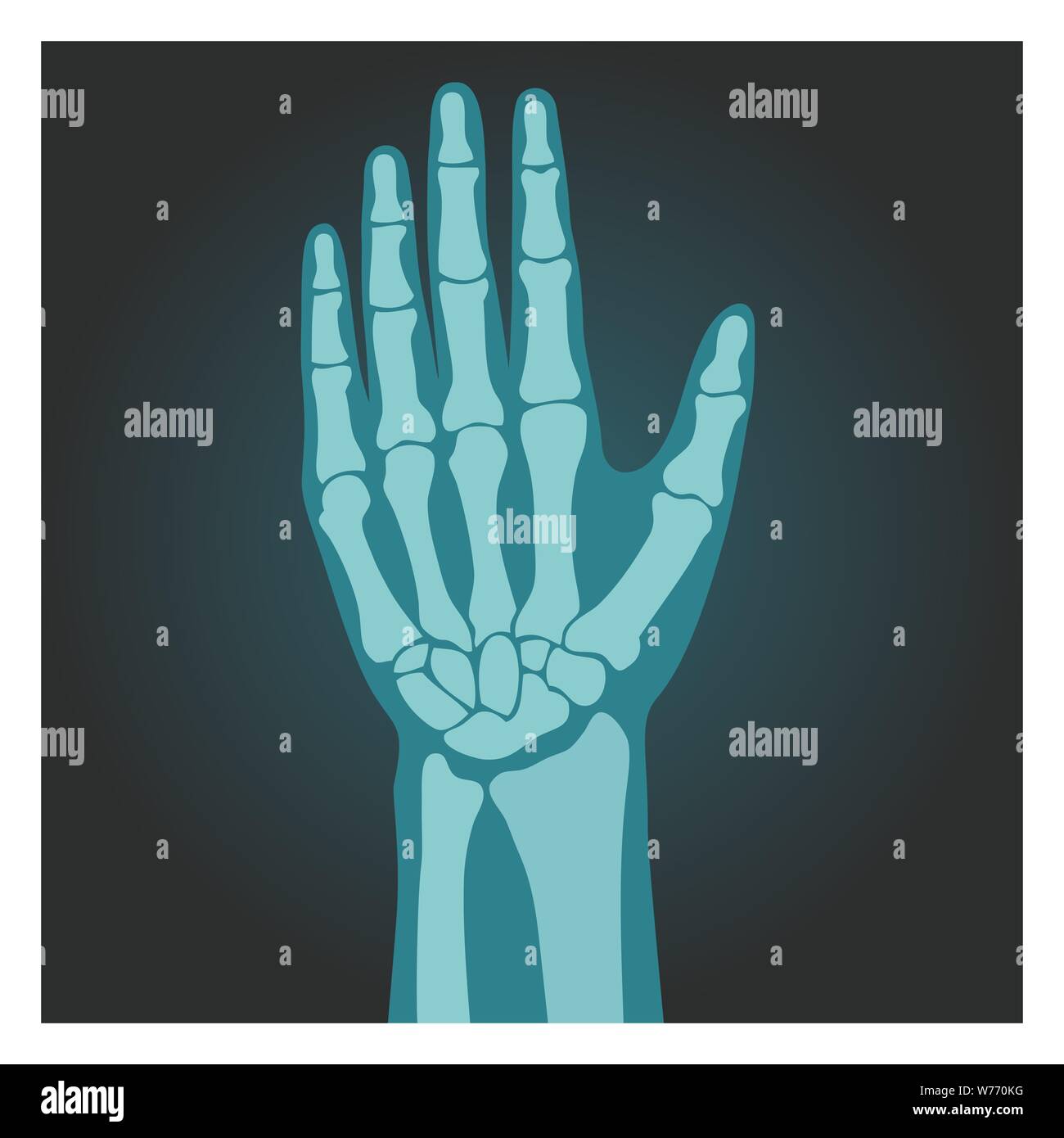 Émission de rayons X de poignet, corps humain, les os de la main, la radiographie, l'illustration vectorielle. Illustration de Vecteur