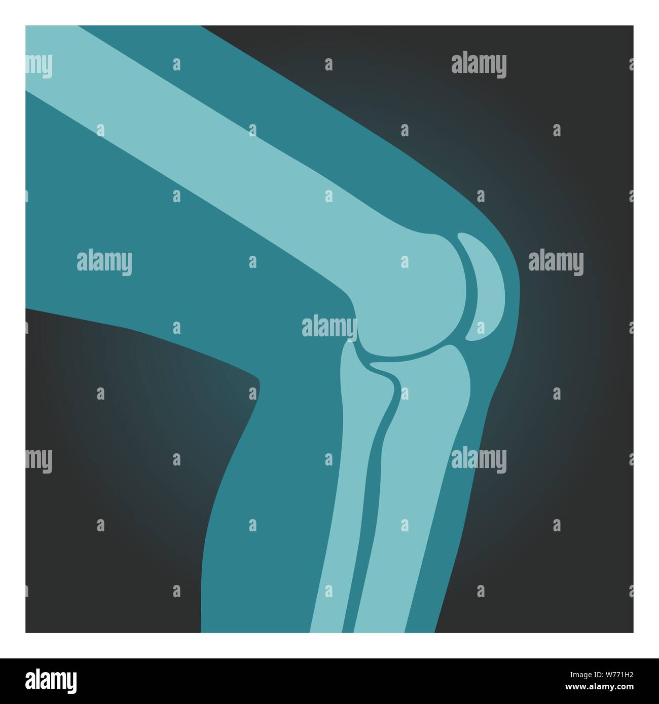 Émission de rayons X de genou, corps humain, les os de la jambe, radiographie, vector illustration. Illustration de Vecteur
