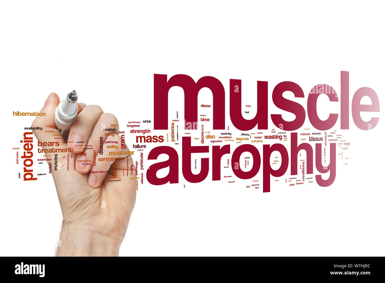 Atrophie musculaire Banque de photographies et d’images à haute