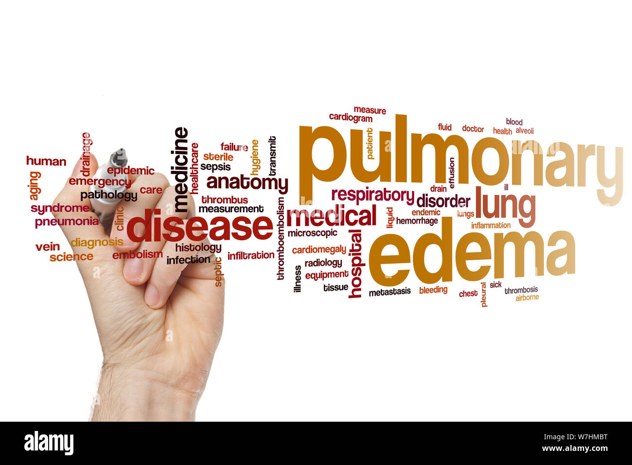 Œdème pulmonaire mot concept cloud Banque D'Images