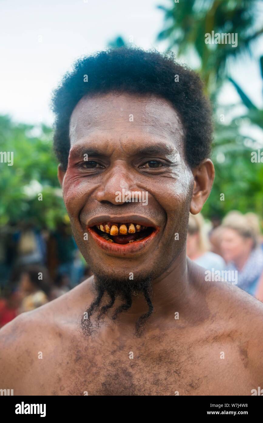 Homme avec les dents rouges de manger asiatique écrou et inhabituel Beard, la mort tabou cérémonie, East New Britain, Papouasie Nouvelle Guinée Banque D'Images
