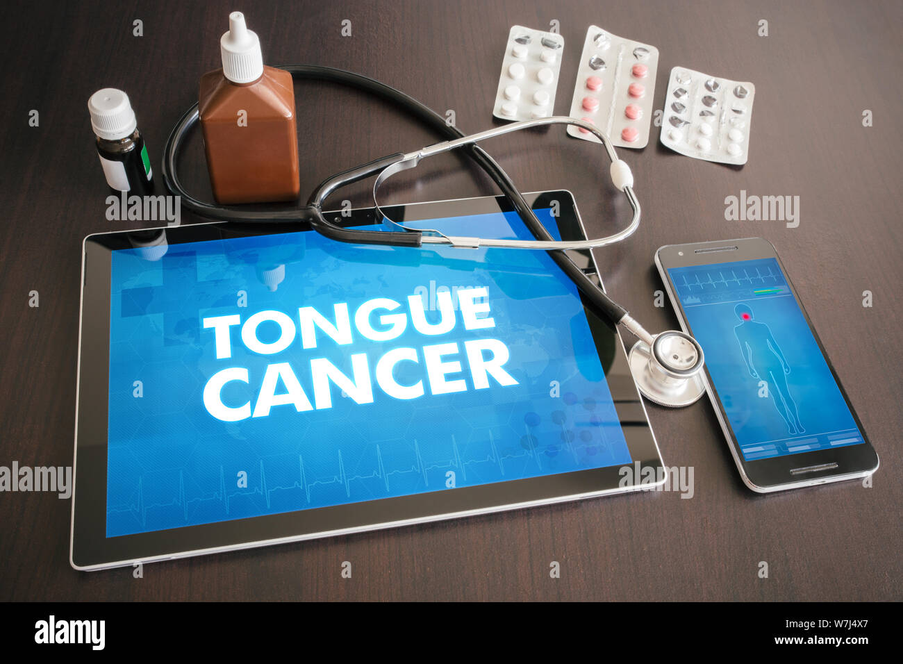 Le cancer de la langue (type de cancer) diagnostic medical concept sur écran de tablette avec stéthoscope. Banque D'Images