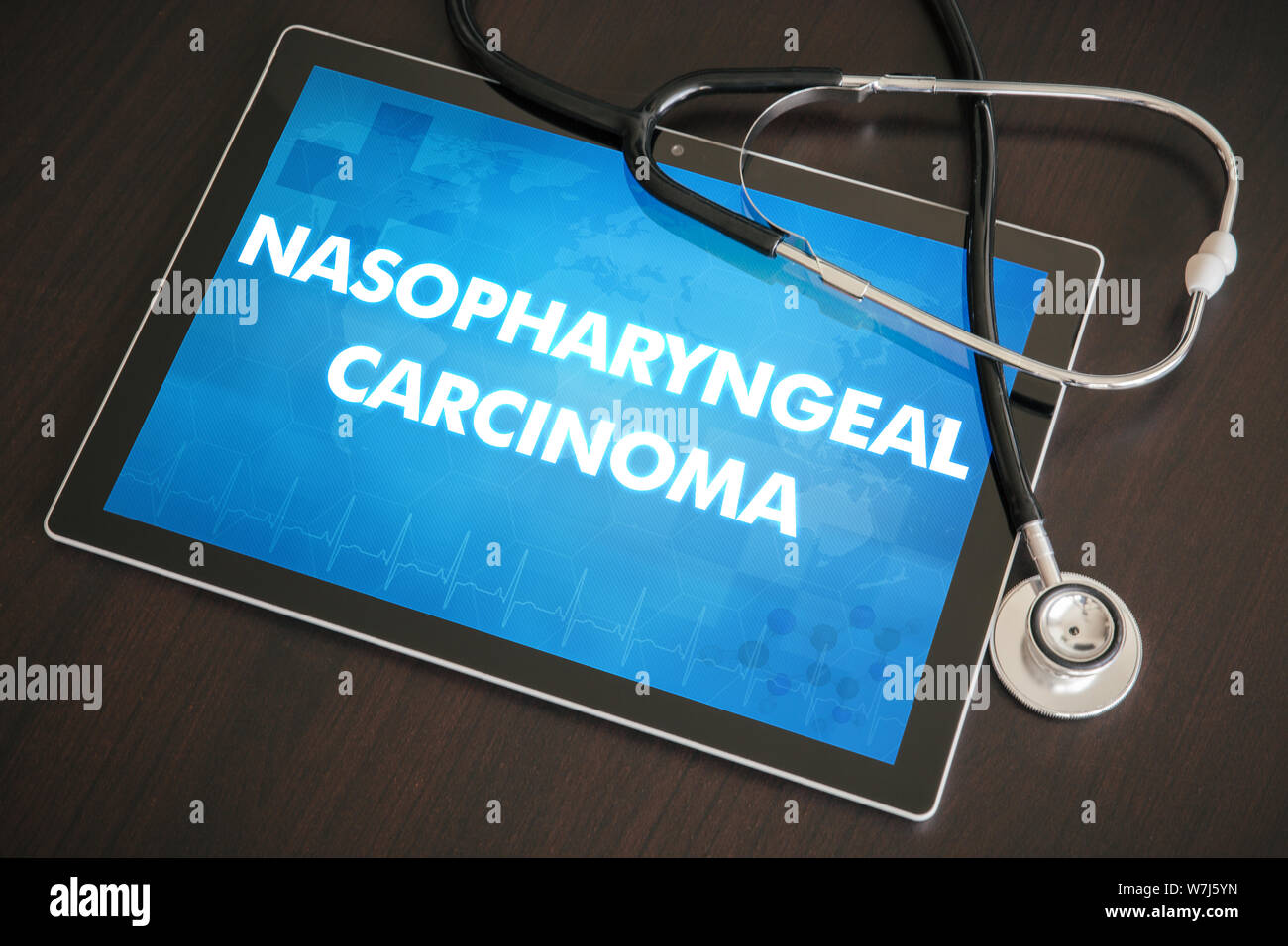 Le carcinome nasopharyngé (type de cancer) diagnostic medical concept sur écran de tablette avec stéthoscope. Banque D'Images