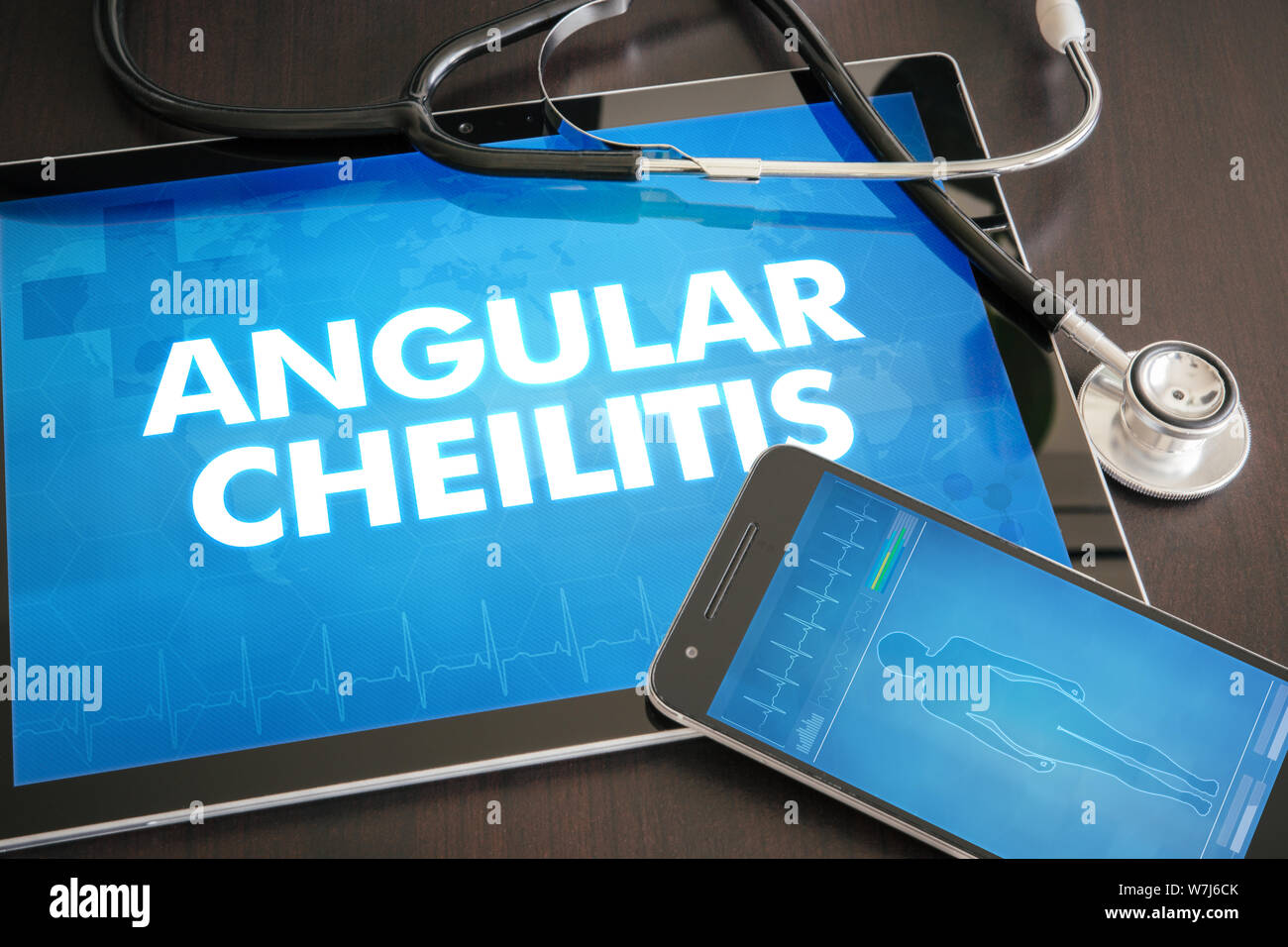 Chéilite angulaire (maladie cutanée) diagnostic medical concept sur écran de tablette avec stéthoscope. Banque D'Images