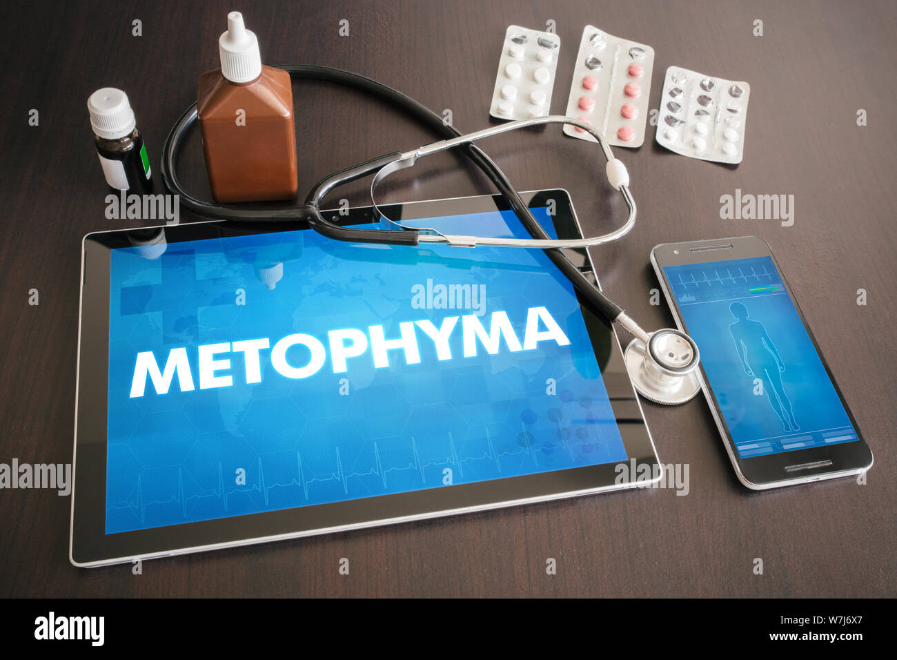 Metophyma (maladie cutanée) diagnostic medical concept sur écran de tablette avec stéthoscope. Banque D'Images
