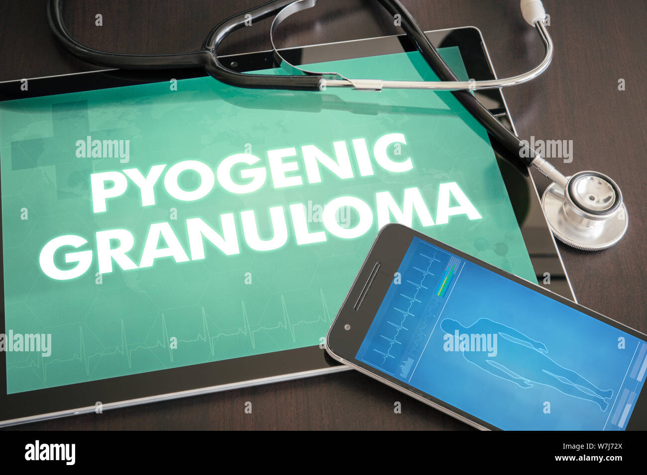 Granulome pyogène (maladie cutanée) diagnostic medical concept sur écran de tablette avec stéthoscope. Banque D'Images