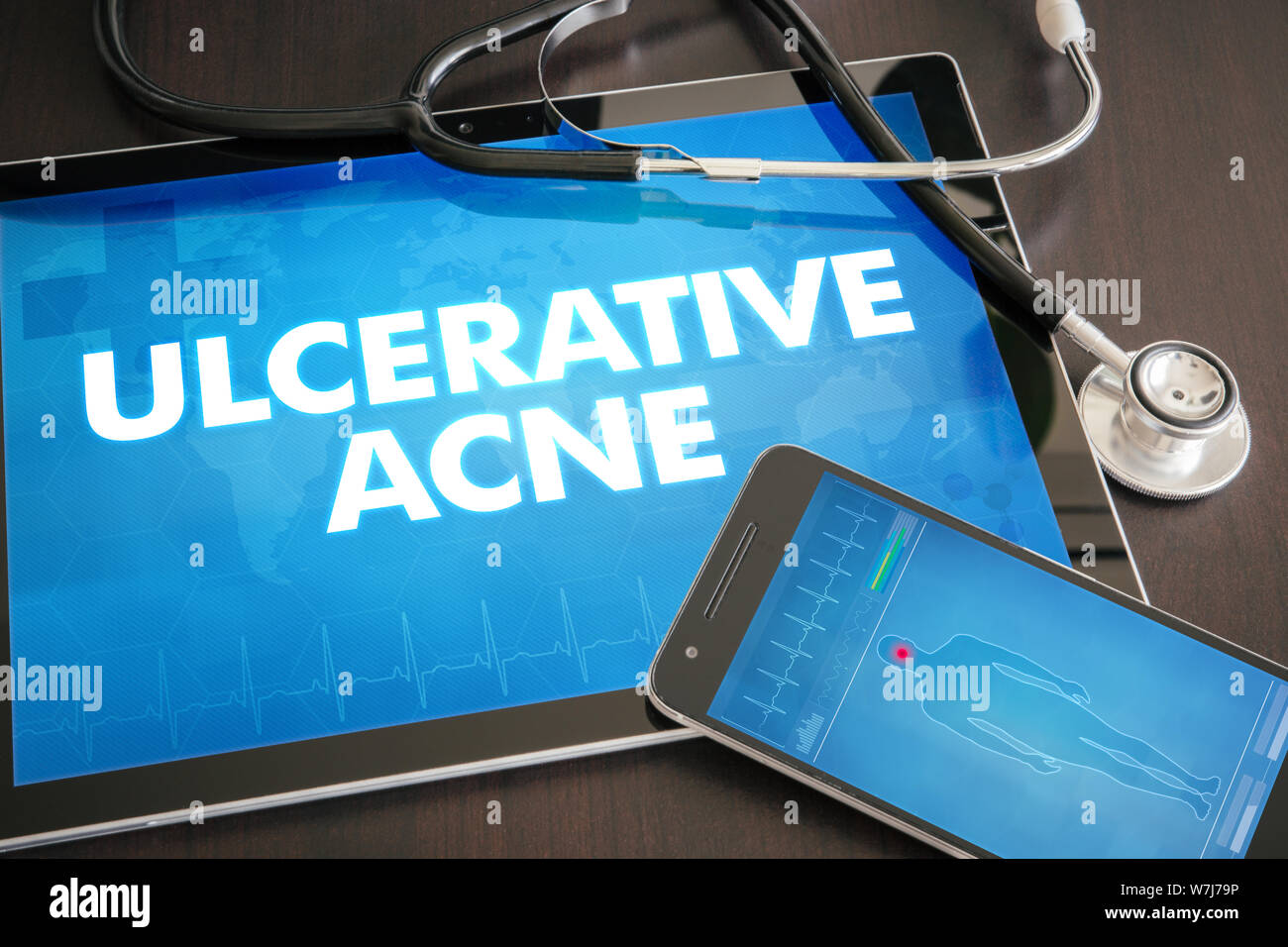 La maladie cutanée (acné) diagnostic medical concept sur écran de tablette avec stéthoscope. Banque D'Images