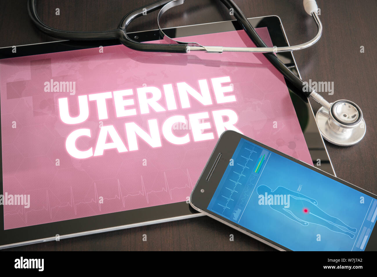 Cancer de l'utérus (type de cancer) diagnostic medical concept sur écran de tablette avec stéthoscope. Banque D'Images