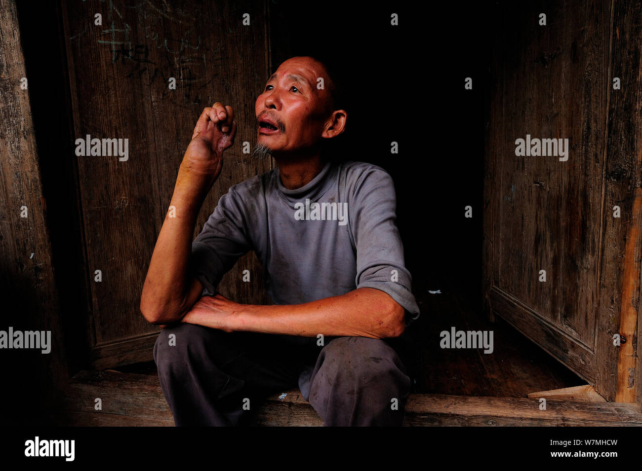 Un vieil homme assis en face de sa maison, avec le bras déformé par centaines-pace pitviper Snake bite (Deinagkistrodon acutus) Fanjingshan National Nature Reserve, province du Guizhou, en Chine, en juin 2008. Banque D'Images