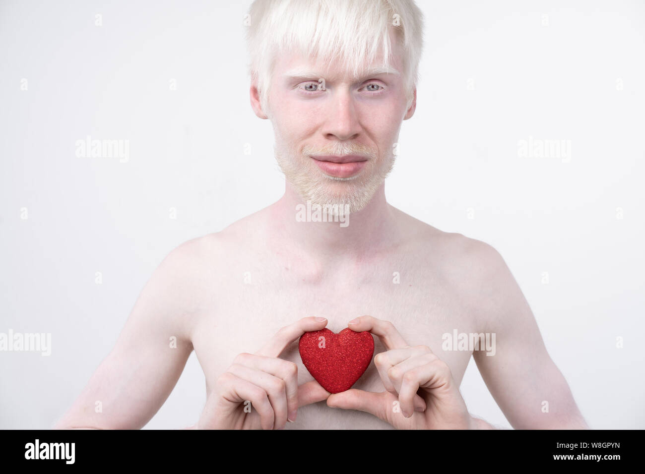 Portrait d'un homme albinos dans studio habillé t-shirt isolé sur un fond blanc. déviations anormales. Aspect insolite anomalie de la peau. Banque D'Images