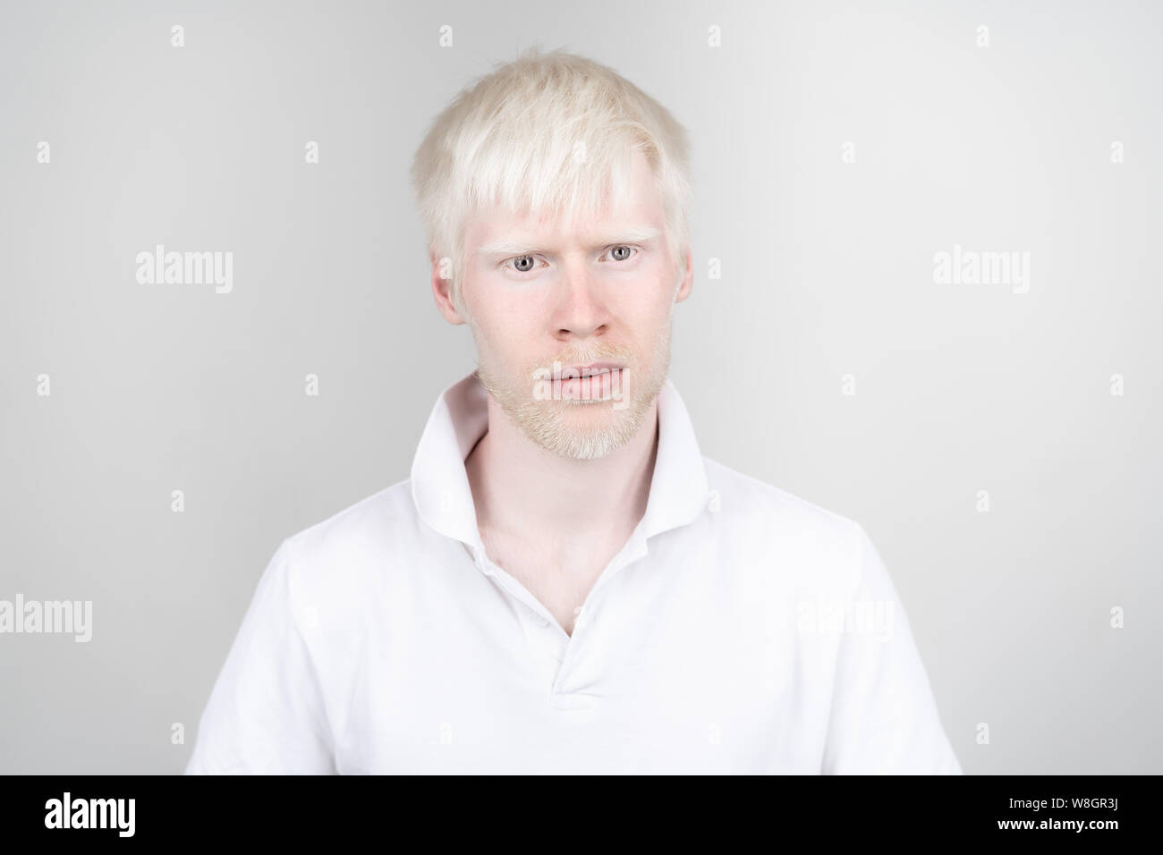 Portrait d'un homme albinos dans studio habillé t-shirt isolé sur un fond blanc. déviations anormales. Aspect insolite anomalie de la peau. Banque D'Images