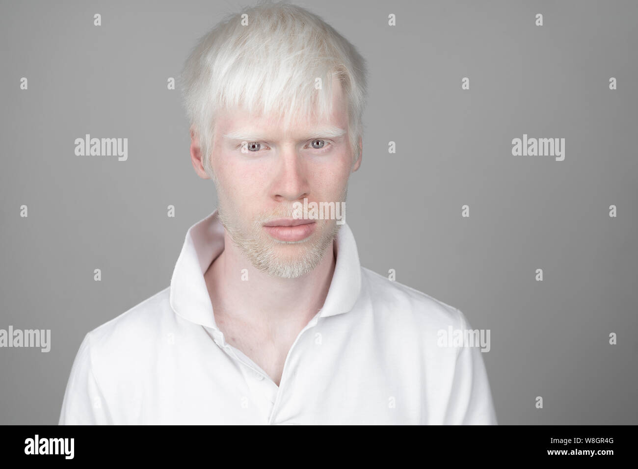 Portrait d'un homme albinos dans studio habillé t-shirt isolé sur un fond blanc. déviations anormales. Aspect insolite anomalie de la peau. Banque D'Images