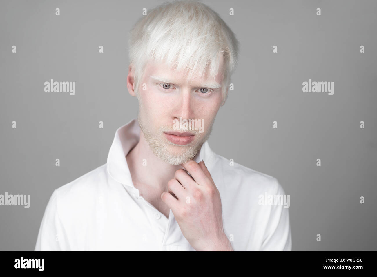 Portrait d'un homme albinos dans studio habillé t-shirt isolé sur un fond blanc. déviations anormales. Aspect insolite anomalie de la peau. Banque D'Images